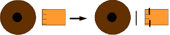 手術の図