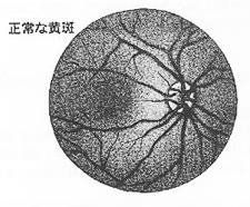 正常な黄斑
