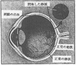 ikfig2