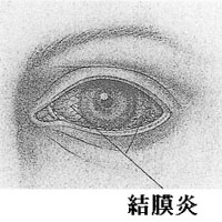 ipfig1