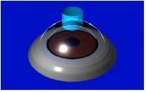 PRK(photorefractive keratectomy)